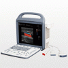 УЗД апарат iuStar 160L